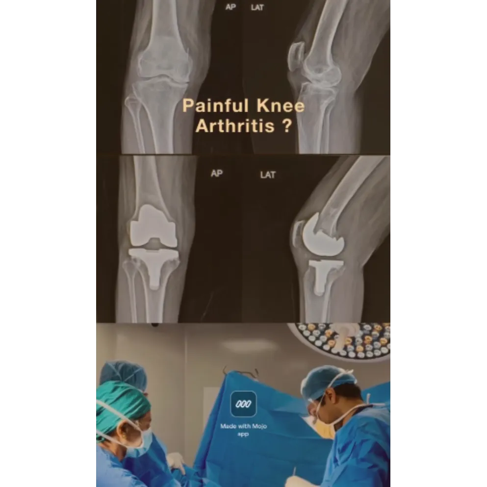 Best Knee Replacement Surgeon in Pune - Dr Gaurav Pawar !