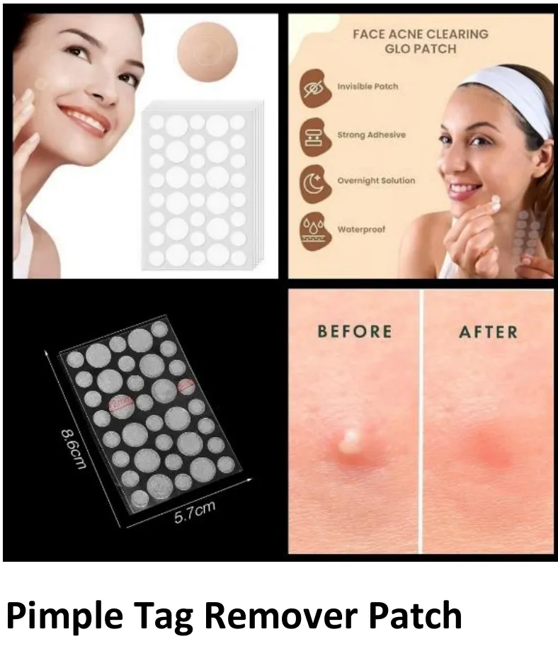 Pimple Tag Remover Patch Available In Kalwa West
