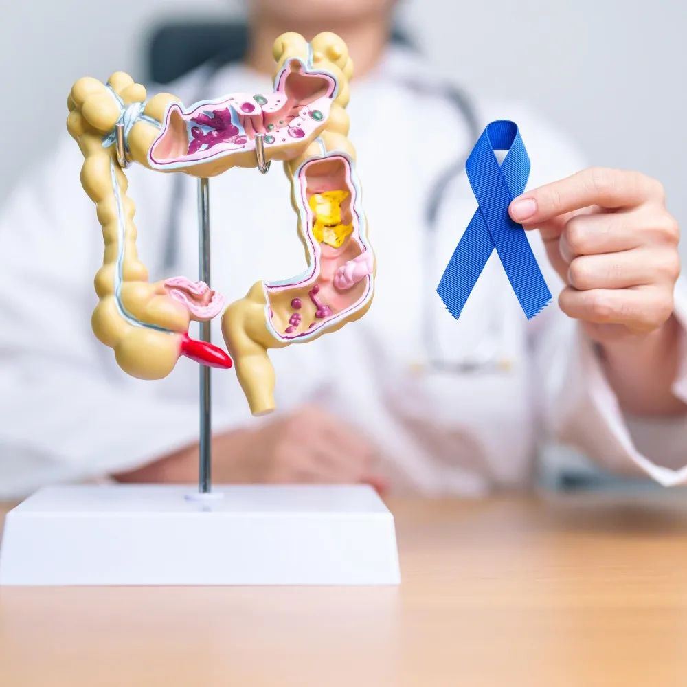 GI Cancer Treatment: Surgery, Chemotherapy, or Targeted Therapy—How Is the Right Option Chosen?