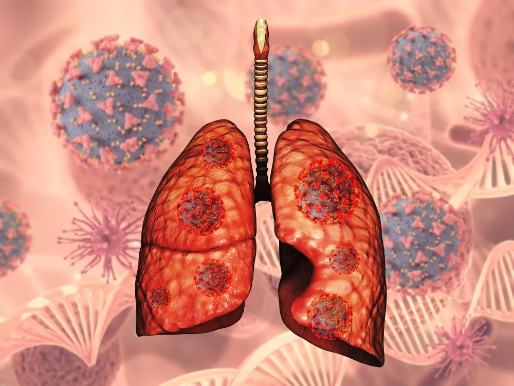 Interstitial Lung Disease (ILD) Specialist in Mumbai | Expert Care for Complex Lung Conditions