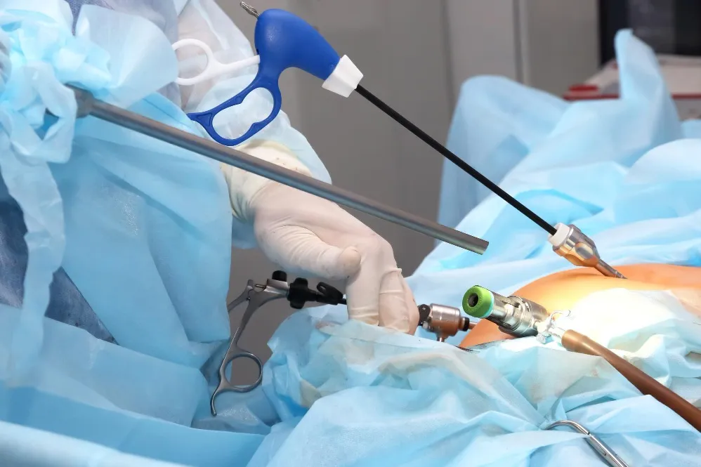 Laparoscopic GI Cancer Surgery in Dombivli East | Advancing Cancer Care Through Minimally Invasive T