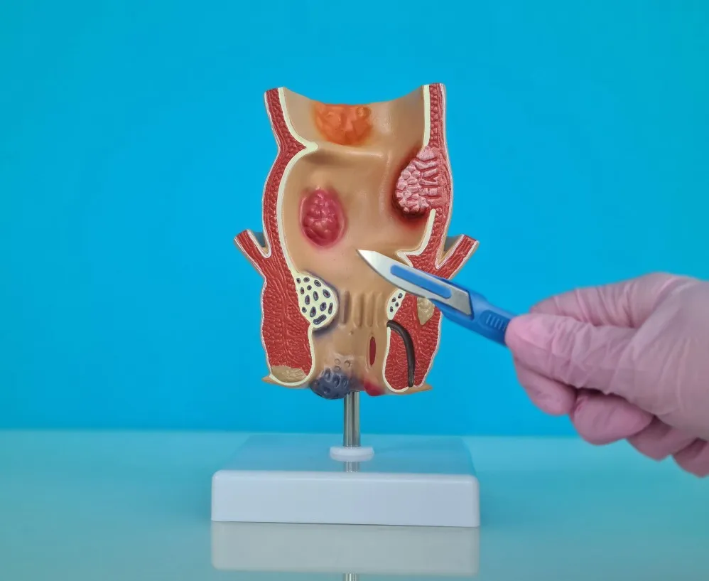 Piles Surgeon in Pune – Why Early Treatment Can Improve Everyday Comfort