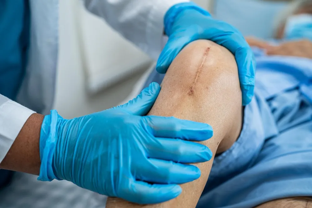 Is Knee Replacement Surgery the Right Choice? What Every Patient Should Know