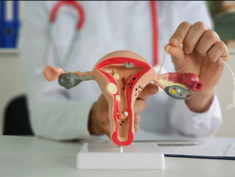 Permanent Sterilization – Who Should Consider This Long-Term Birth Control Option?