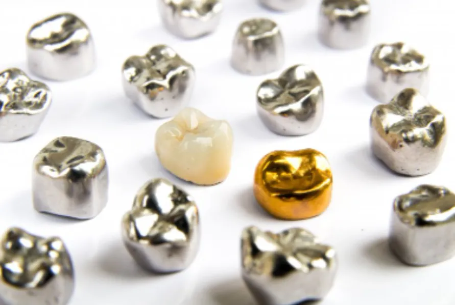 Why a Metal Crown Cap May Still Be the Best Choice for Certain Teeth