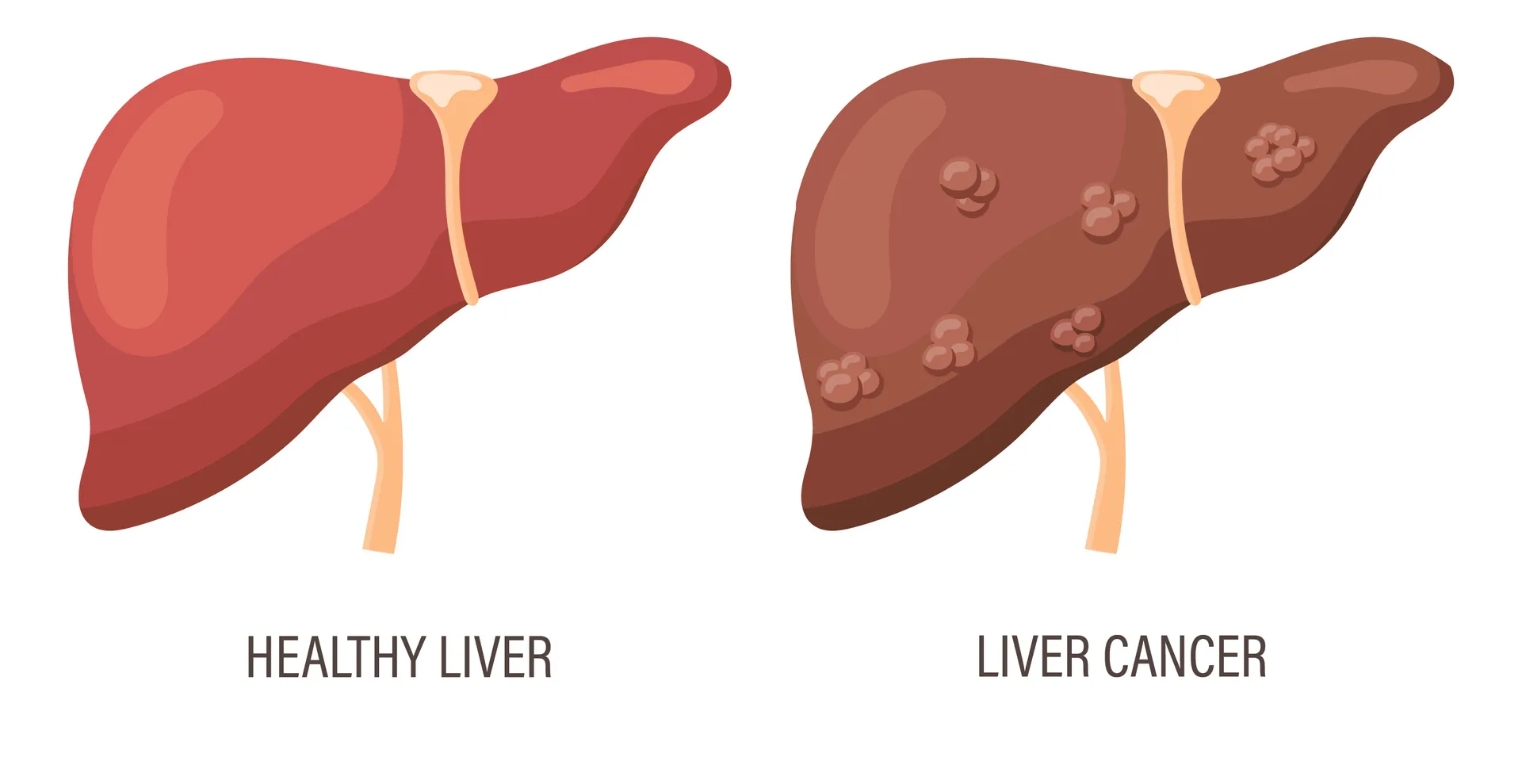 Liver Cancer Specialist in PCMC: Early Signs, Risk Factors, Diagnosis, and Modern Treatment Options