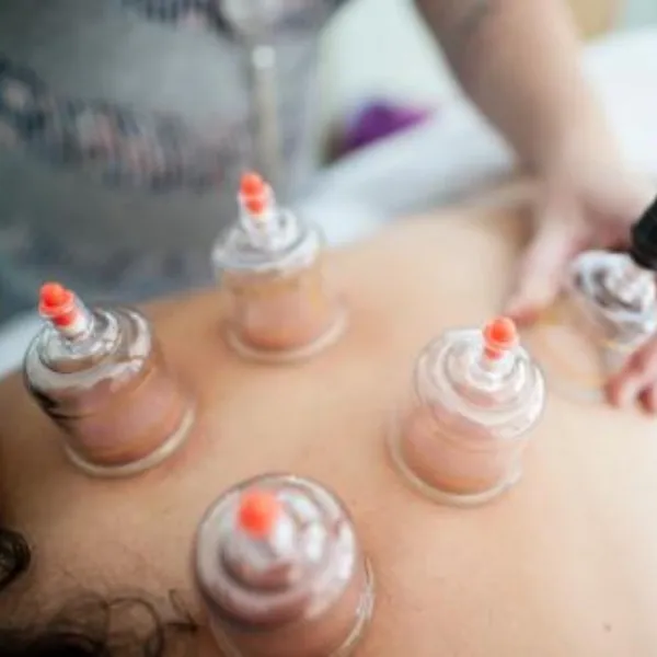 Cupping Therapy in Vadodara