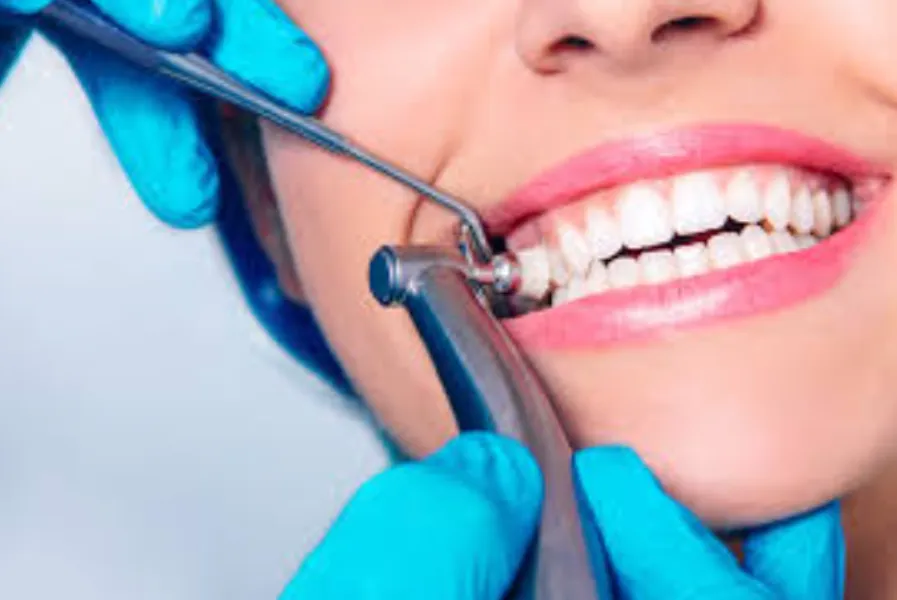 Why Professional Cleaning and Polishing Treatment Is Essential for Healthy Teeth