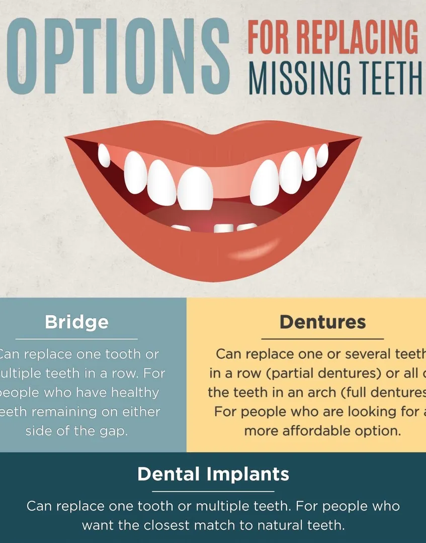Importance of Replacing Missing Teeth