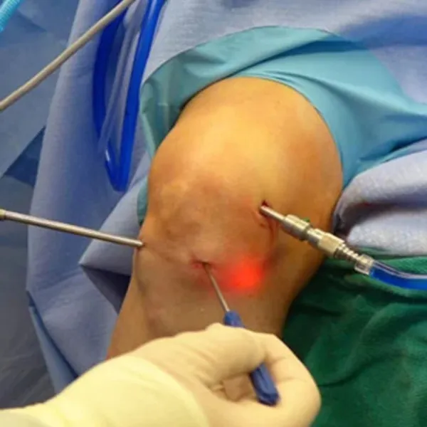 Best Orthopedic Surgeon in Kolshet, Thane