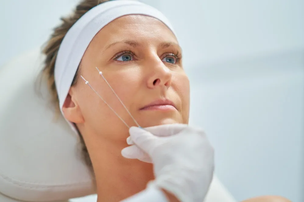 Thread Lift Rejuvenation in Charni Road A Non-Surgical Approach to Skin Firmness