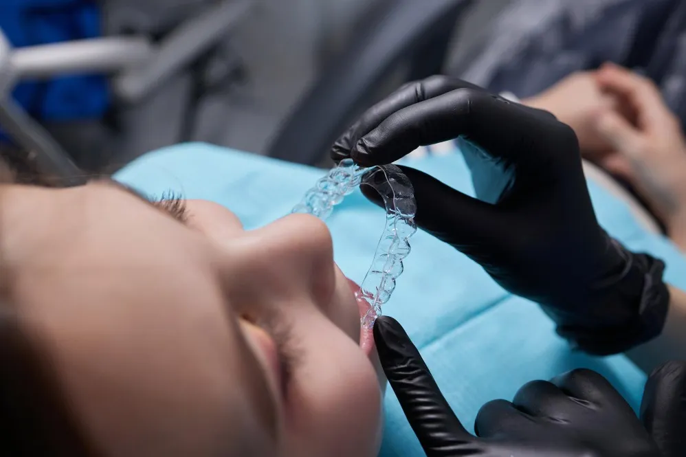 Teeth Gap Closure Treatment in Thane