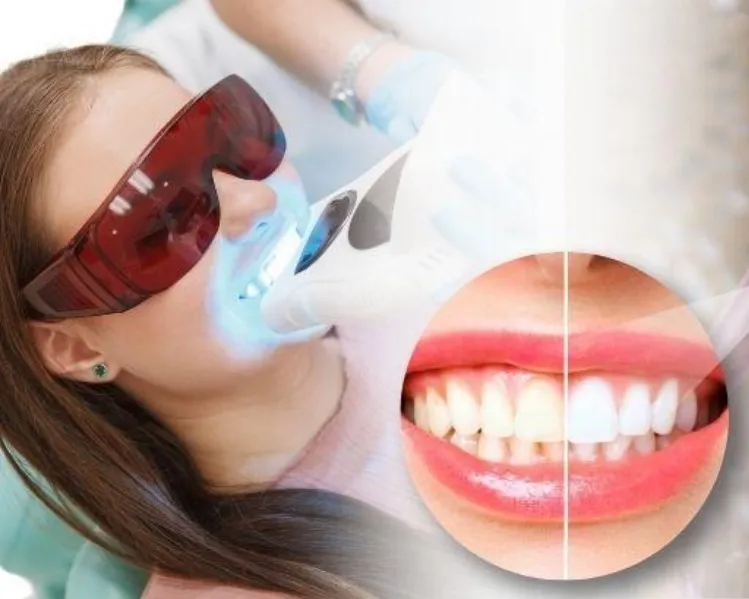 Wedding Smile Makeover: How to Get Your Perfect Smile Before the Big Day