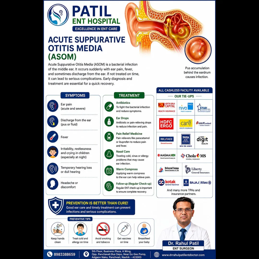 Acute Suppurative Otitis Media (ASOM) Treatment in Nashik | Patil ENT Hospital
