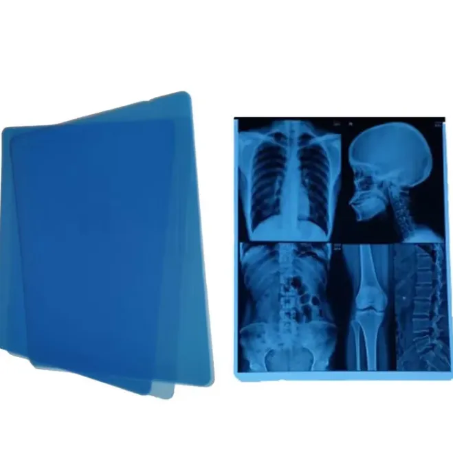 Inkjet Blue Base Film vs Traditional X-Ray Film: Which Option Makes More Sense for Healthcare Facili