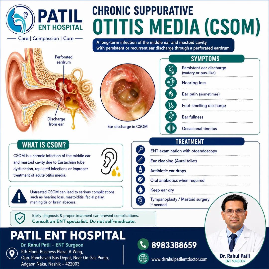 Chronic Suppurative Otitis Media (CSOM): Symptoms, Causes & Advanced Treatment | Patil ENT Hospital,