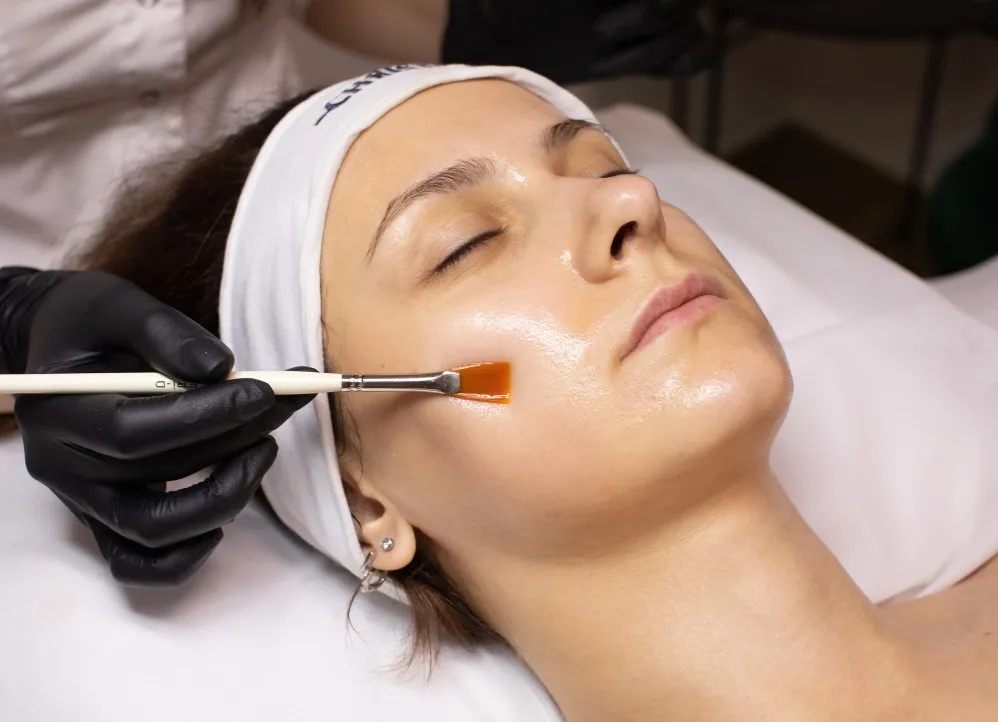 Chemical Peels for Brighter, Healthier Skin: Benefits, Procedure, and Recovery