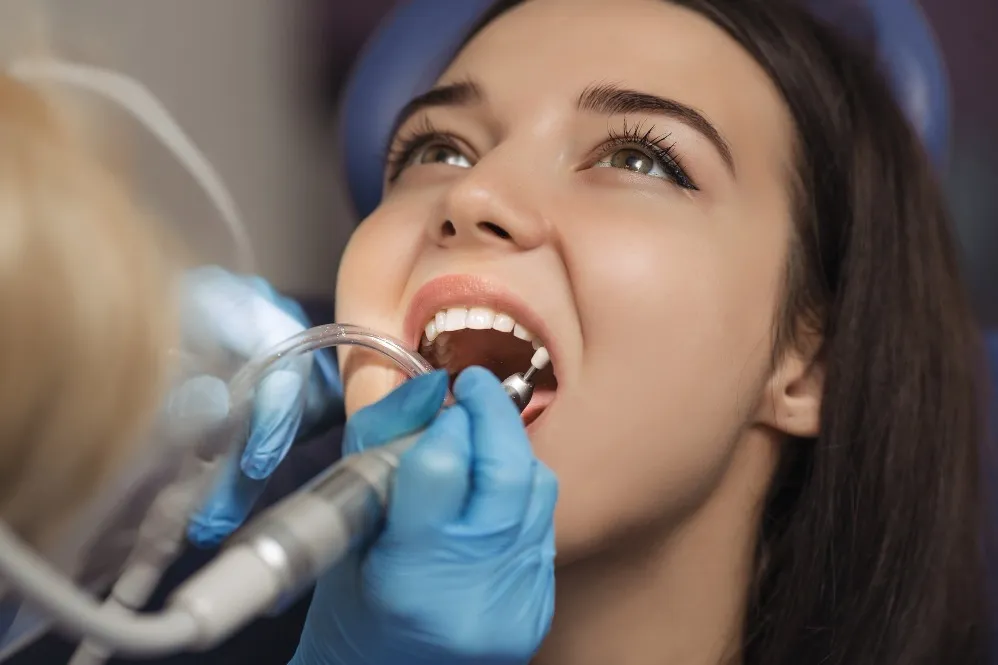 Teeth Cleaning in Sadashiva Nagar: Why Regular Professional Cleaning Matters