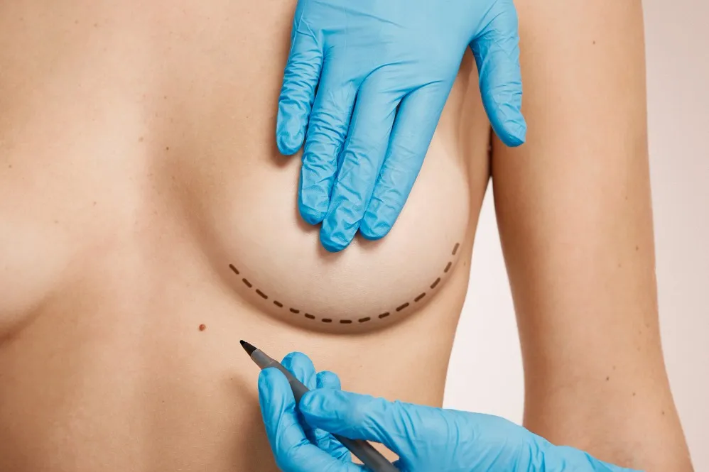 Breast Augmentation in Bengaluru: What to Know Before Considering Surgery