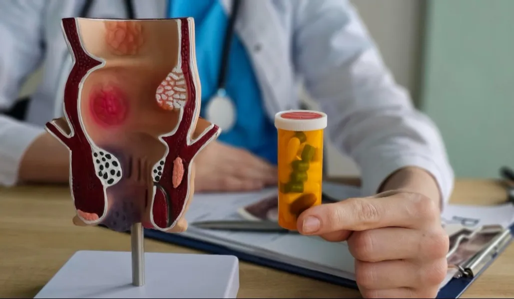 Expert Treatment for Painful Hemorrhoids in Vashi Naka: When Home Remedies Are No Longer Enough