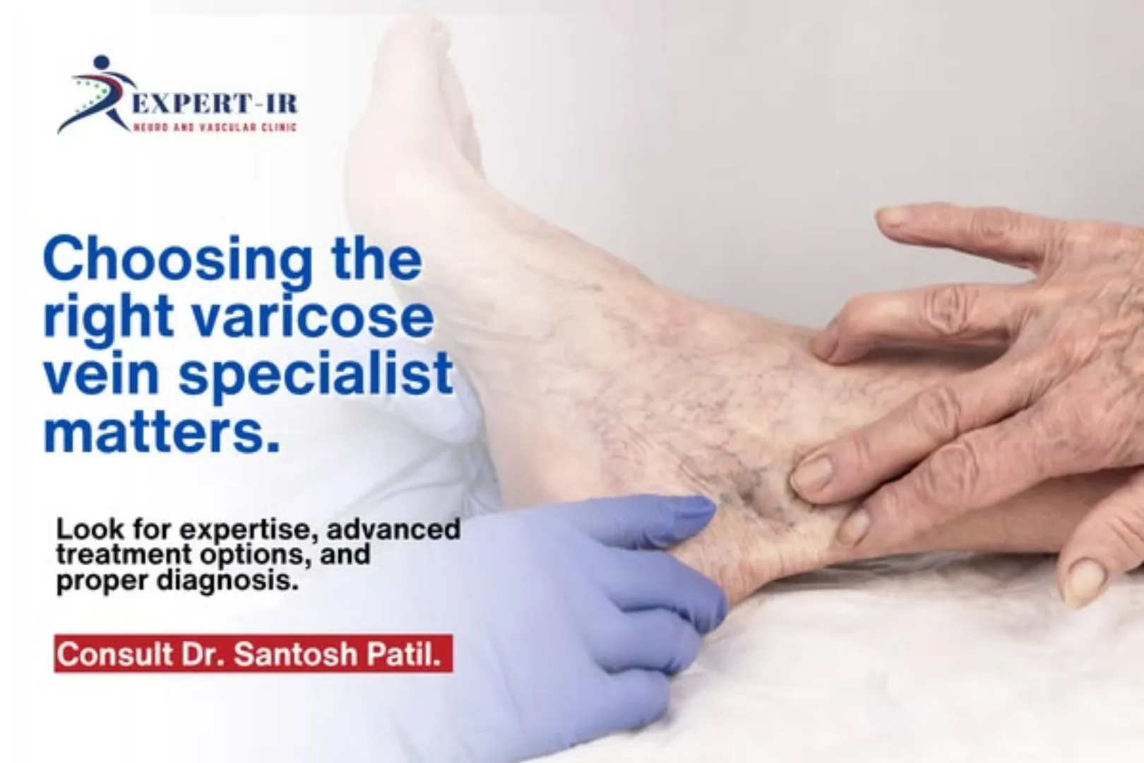 best doctor in pune for varicose veins treatment.