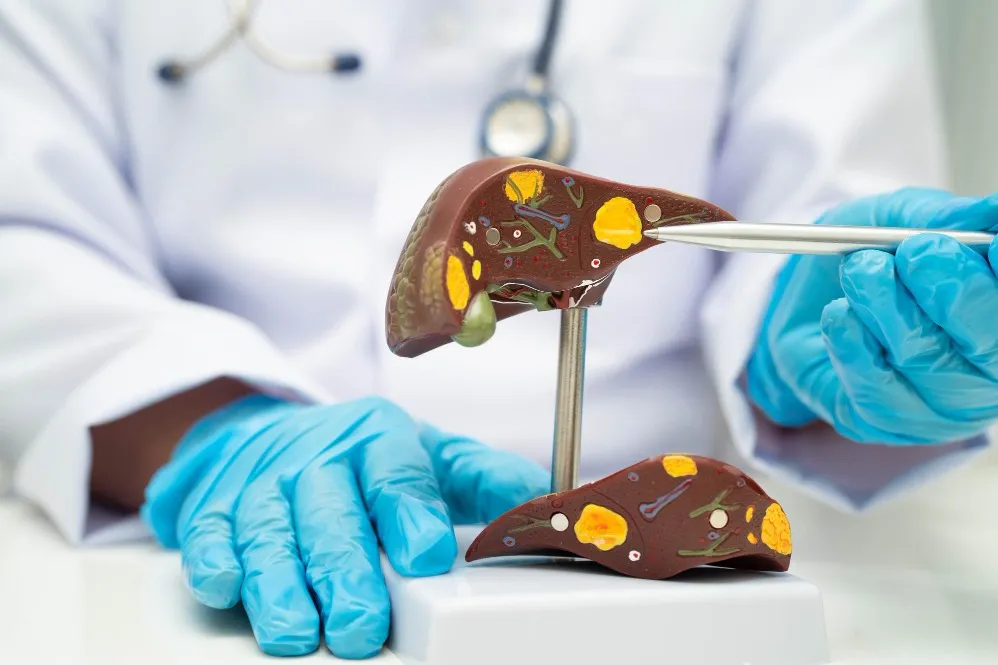 Early Hepatic Encephalopathy Diagnosis in India: Recognising the Warning Signs