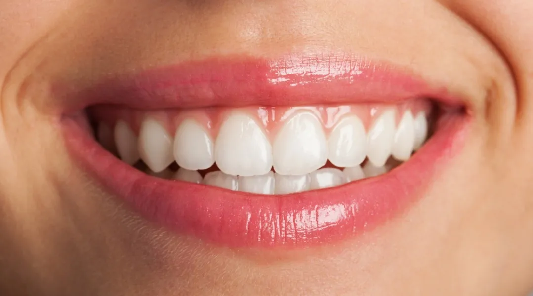 What a Smile Makeover Can Change Beyond the Appearance of Teeth