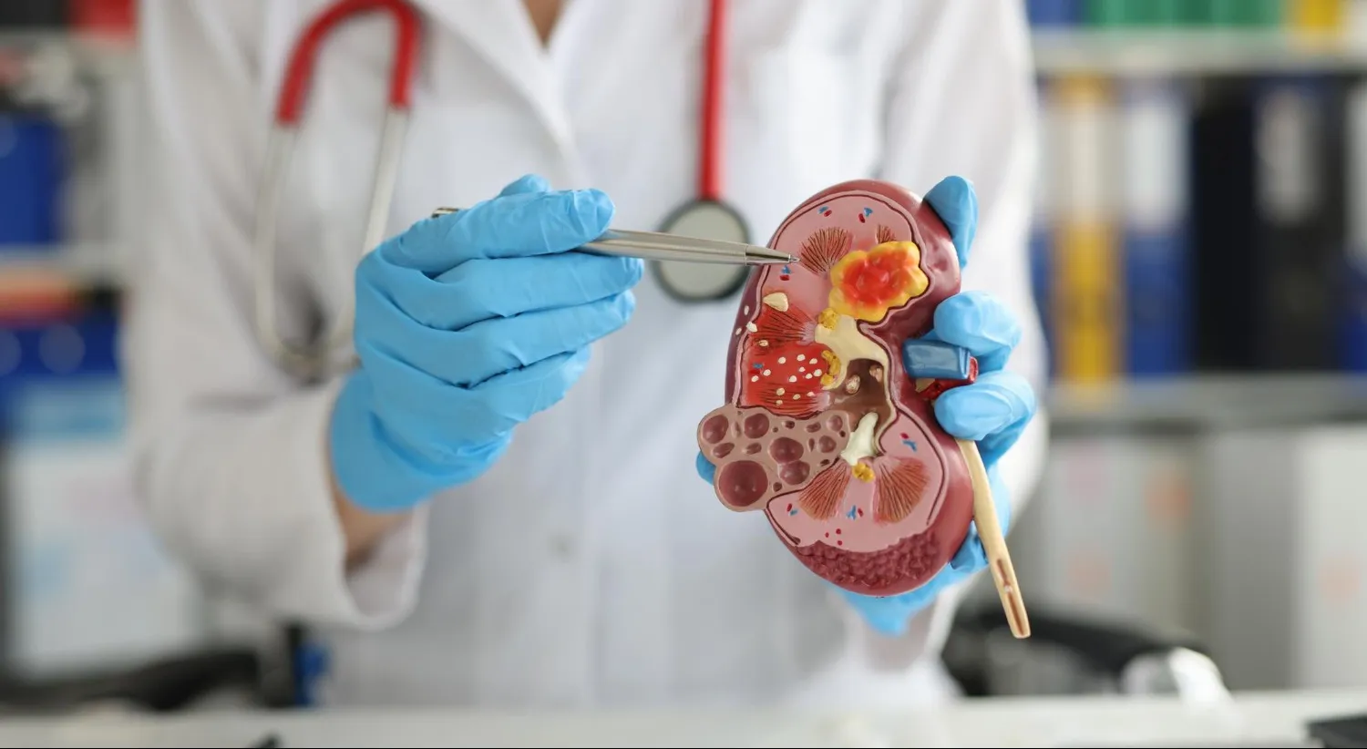 Kidney Diseases Treatment Starts With Early Detection and Metabolic Health Management