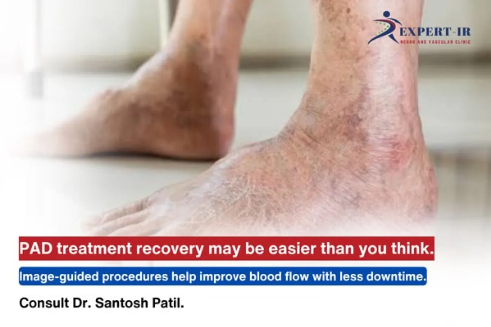 PAD treatment recovery may be easier than you think.