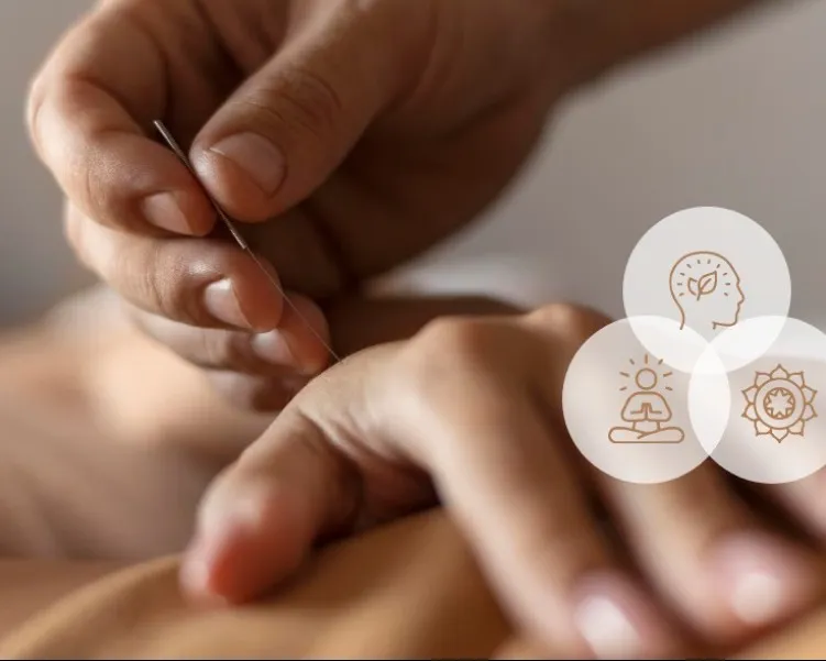 Acupressure Treatment in Janakpuri