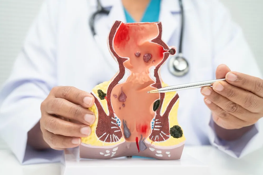 What Patients Should Expect from the Best Laser Piles Doctor During Treatment