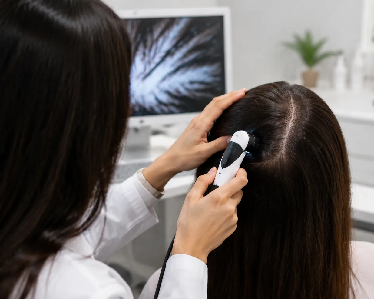 Hair Regrowth Clinic or Home Remedies: What Works for Persistent Hair Fall?