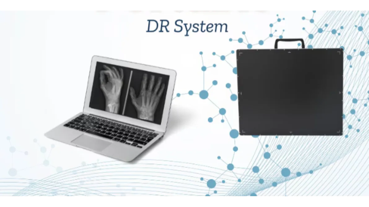 Is a Refurbished DR System Worth Buying? A Practical Guide for Hospitals and Diagnostic Centres in N