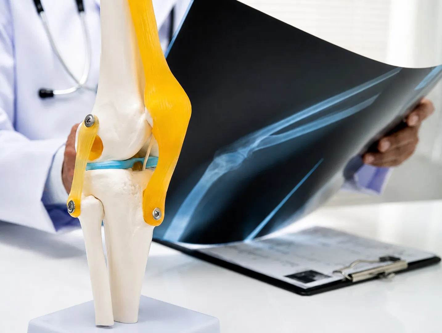 Understanding Knee Arthritis and Treatment Options for Patients in Matunga