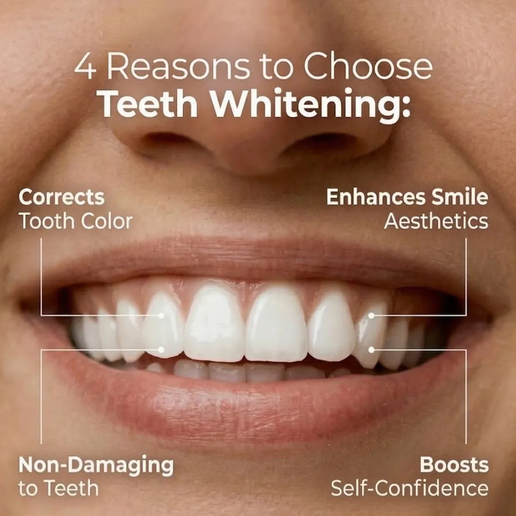 Benefits and Safety of Teeth Whitening: A Brighter Smile