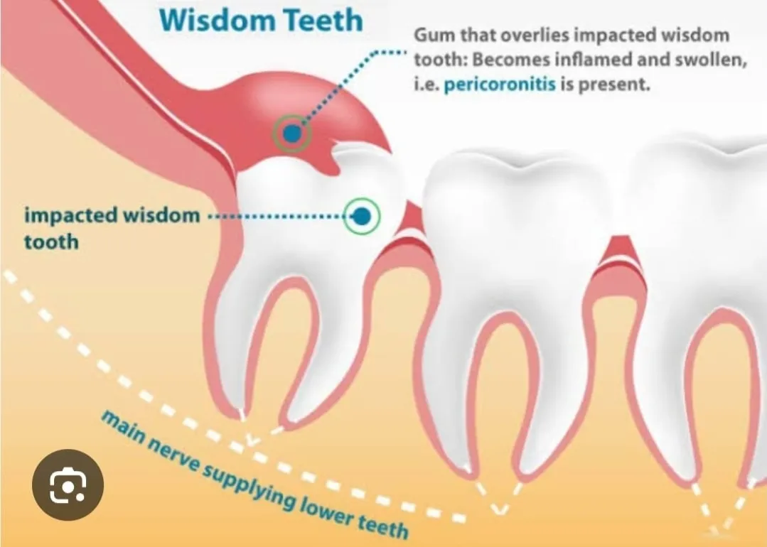 Dentist doctor in wadgaonsheri -Bandewar clinic