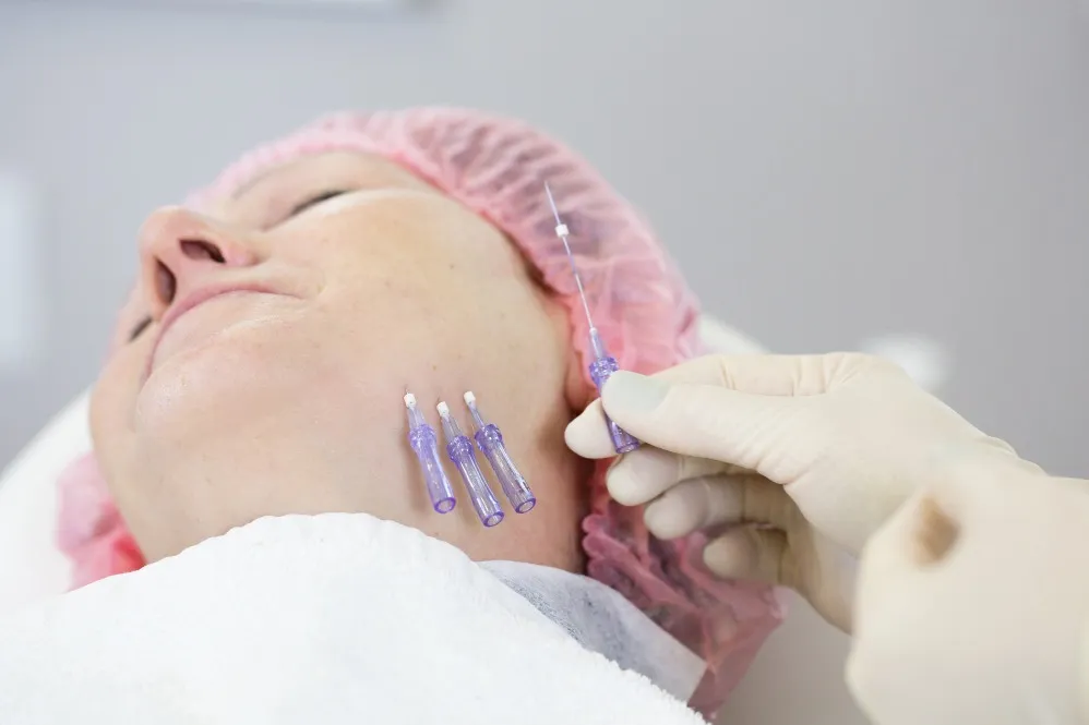 Thread Lift or Face Tightening Treatment: How to Decide Which Is Right for You