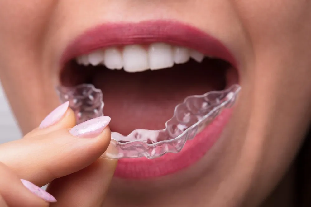 Bite Alignment Treatment in Thane and Why Your Bite Matters