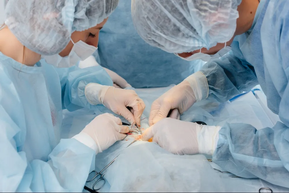 Circumcision Surgery When Is It Recommended and What Can You Expect?
