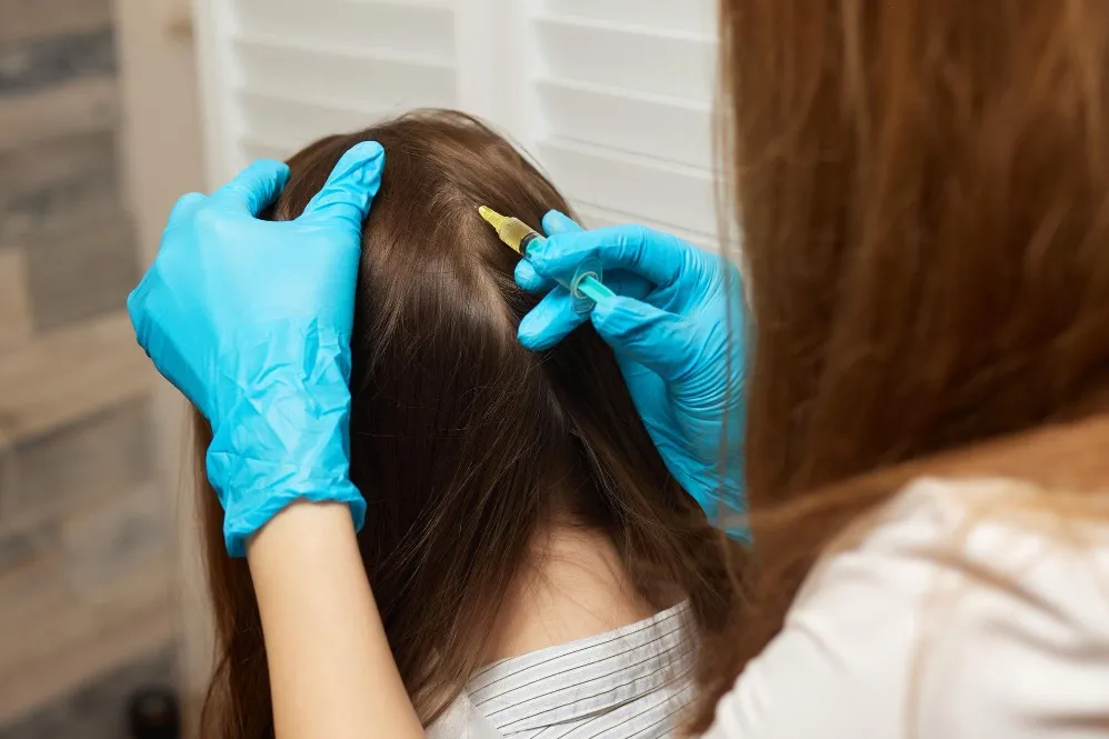 How Exosome Therapy for Hair Regrowth Supports Healthier Hair Growth