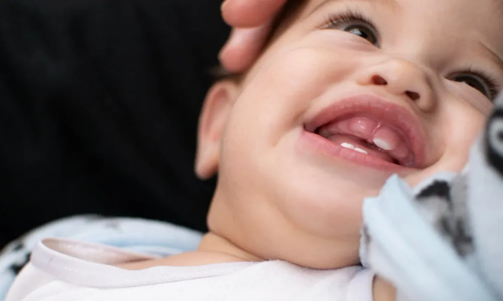 Why a Space Maintainer Can Protect Your Child's Growing Smile