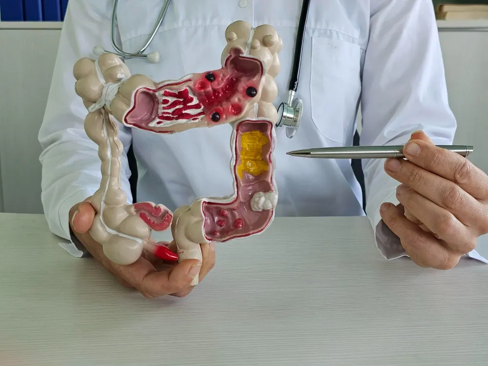 When Should You Consider Surgical Treatment for Chronic Constipation?