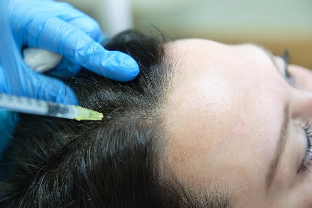 A Practical Hair Fall Treatment Checklist Before Starting Therapy
