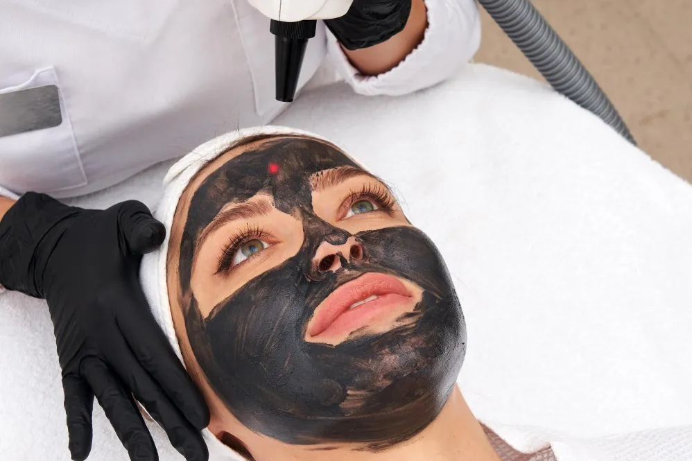 How Carbon Peel Supports Clearer Looking Skin