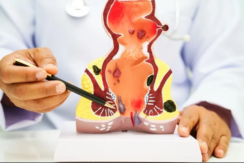 Perianal Abscess Specialist in Bangalore – Early Treatment Can Prevent Further Complications