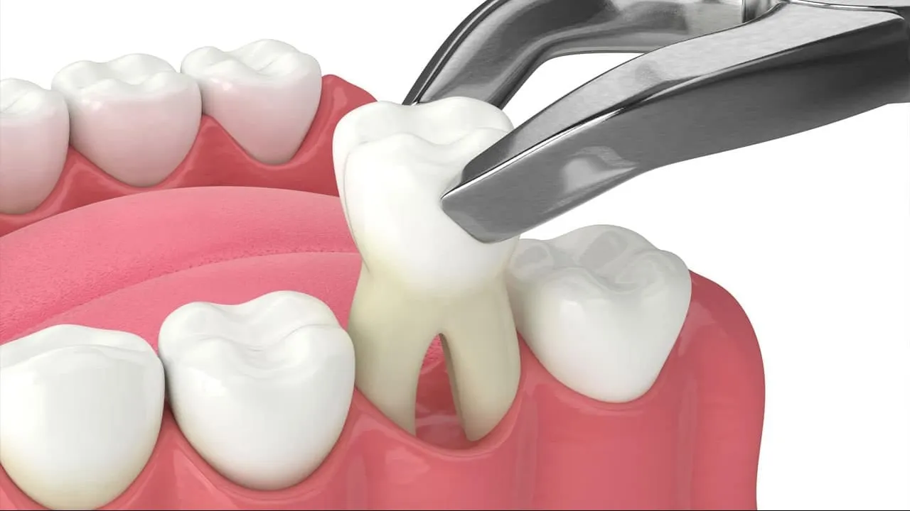 Best Extraction In Vashi