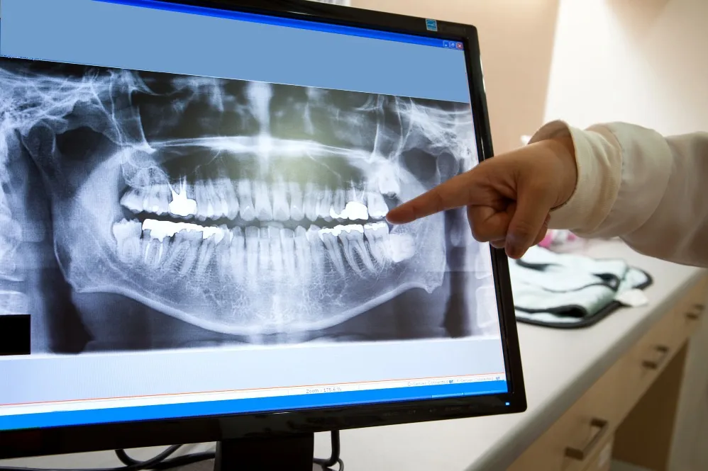 Dental X-Ray Services Improve Diagnosis and Treatment Planning