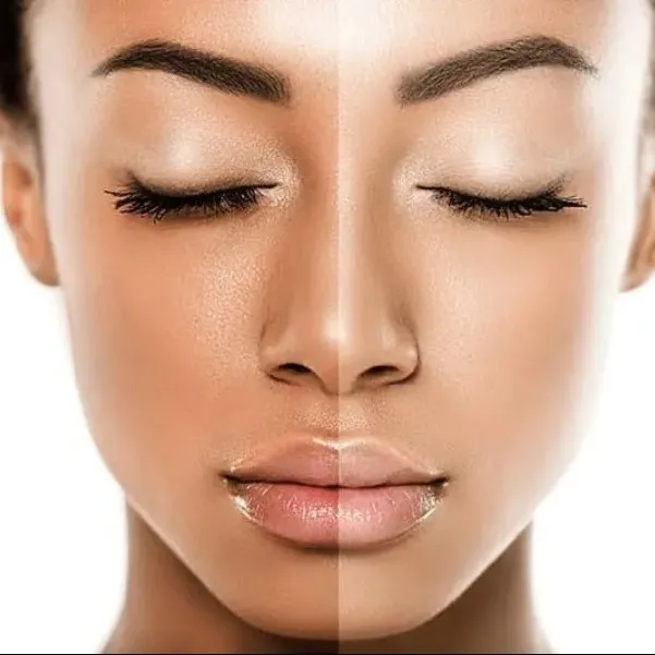 Best Skin Whitening Treatment in Delhi