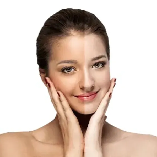 Best Skin Lightening Treatment in Delhi