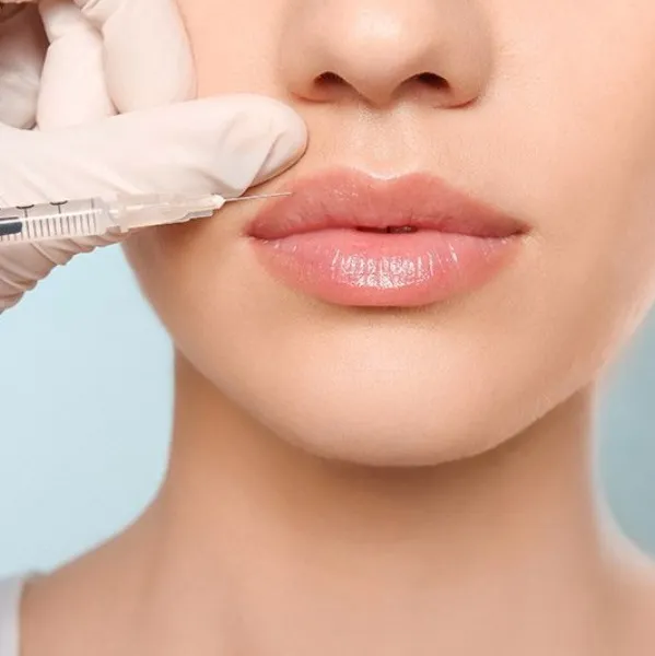 Best Dermal Fillers in Delhi